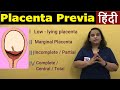 Placenta Previa in Hindi | APH Antepartum Hemorrhage-Types, Risk factors, Symptoms | Nursing Lecture