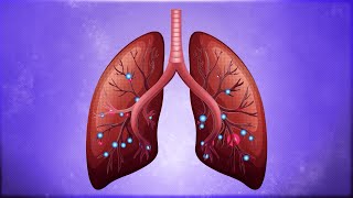 Severe viral lung infections and ARDS, causes and effects