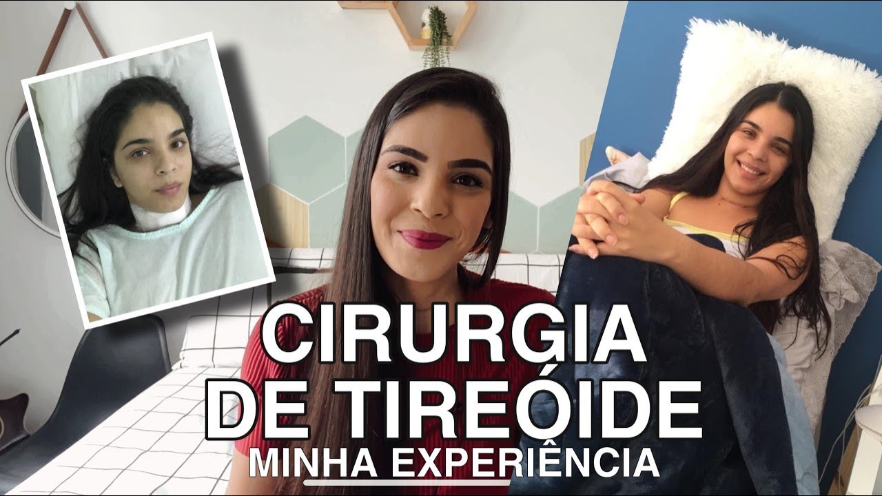 TIVE CÂNCER NA TIREÓIDE | CARCINOMA PAPILÍFERO - Nós dois e uma vida