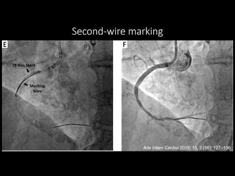 Low or No Contrast PCI