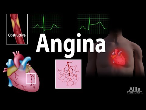 Angina: Stable, Unstable, Microvascular and Prinzmetal, Animation