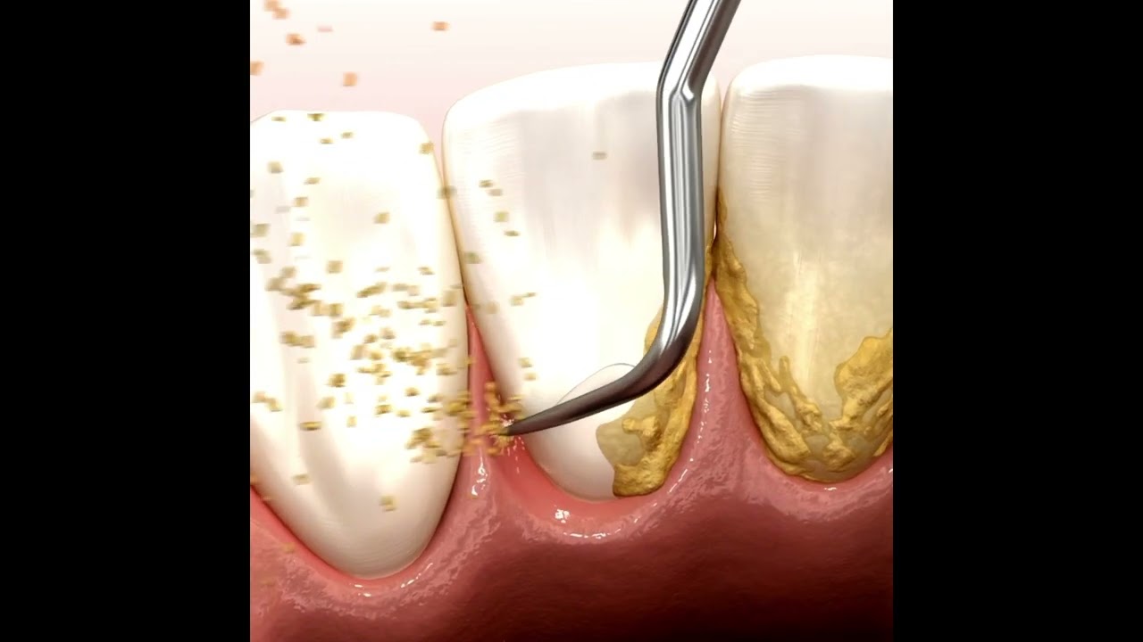 Joel Alejandro Sánchez Zúñiga-6