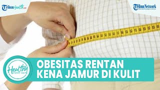 Penderita Obesitas Rentan Terkena Infeksi Jamur Kulit, Begini Penjelasan dr Halim Perdana