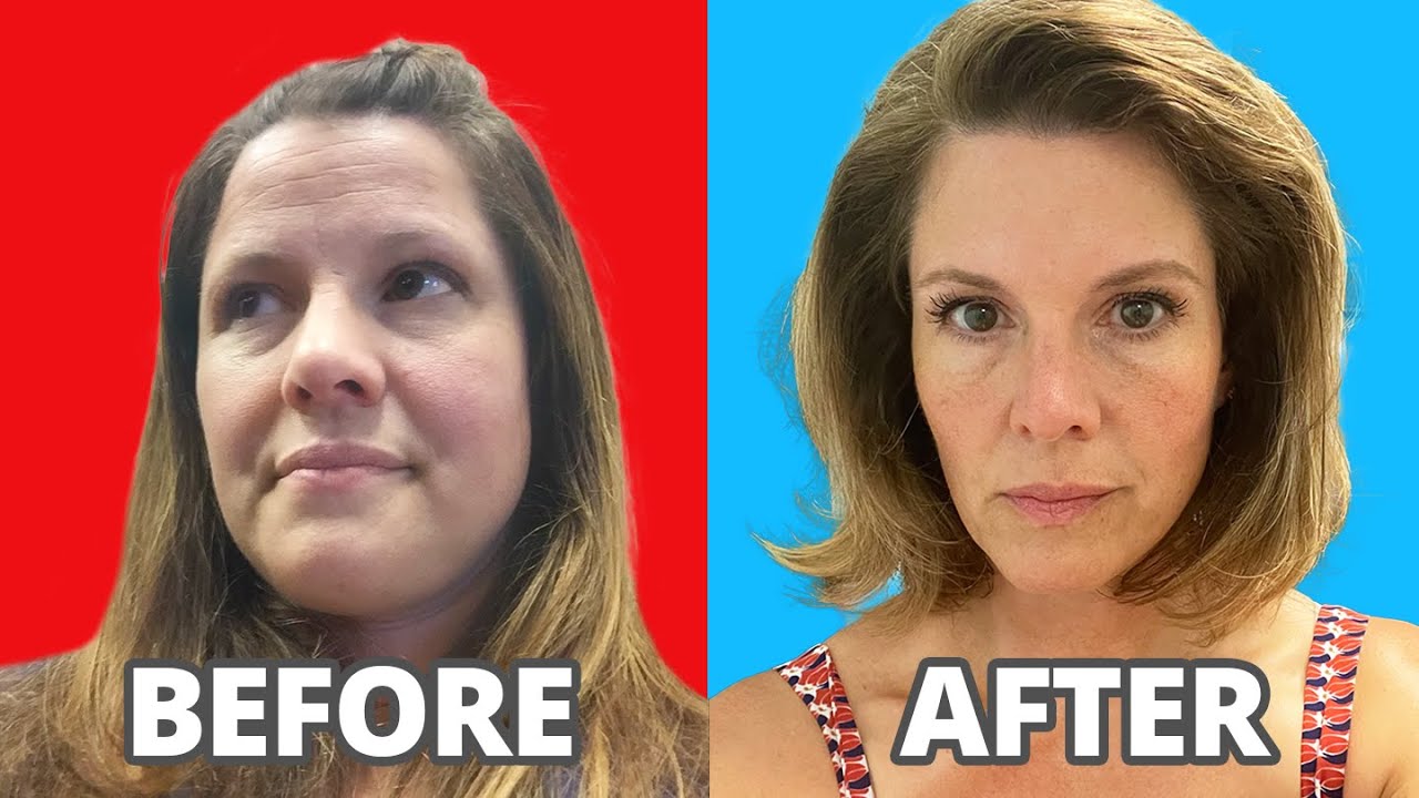 5 things my face tells you about insulin resistance