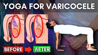 Download lagu Yoga for Varicocele Relief | Part 1 Home Routine for Testicular Health #varicocele mp3