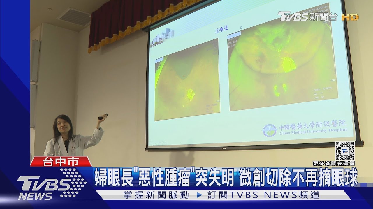 婦眼長「惡性腫瘤」突失明 微創切除不再摘眼球
