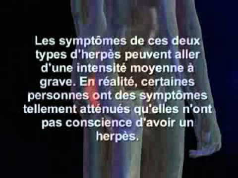 comment soigner bouton d'herpes sur la levre