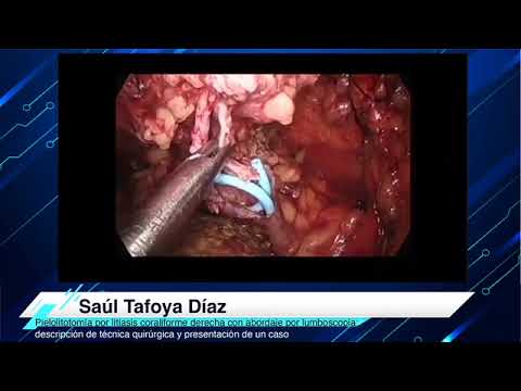 Saúl Tafoya Diaz-9