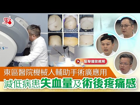 東區醫院機械人輔助手術廣應用　減低病患失血量及術後疼痛感