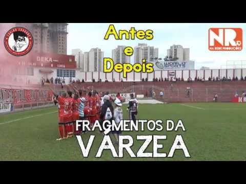 Fragmentos da Várzea - Antes e Depois (Futebol de Várzea)