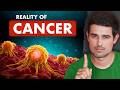 Cancer The Scariest Disease In Humans How To Be Safe Dhruv Rathee