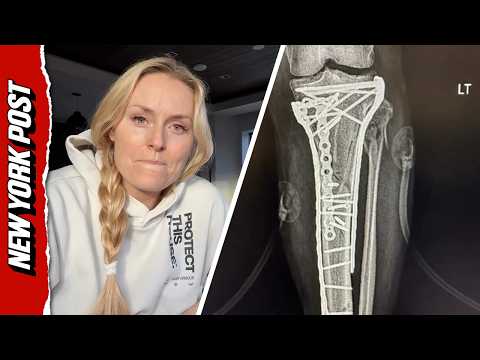 Lindsey Vonn REVEALS How Close She Was to Having Leg Amputated After Devastating Olympics Ski Crash