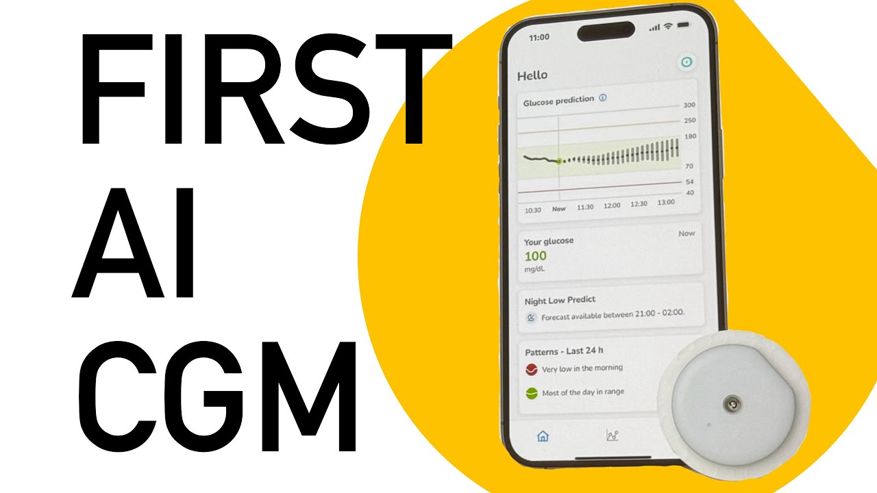 First AI CGM is here- Roche SmartGuide CGM