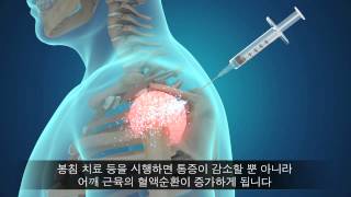 ����������� ��� ġ���ϳ���? ������