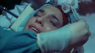 Faceless (1988) -Surgery Scene 2