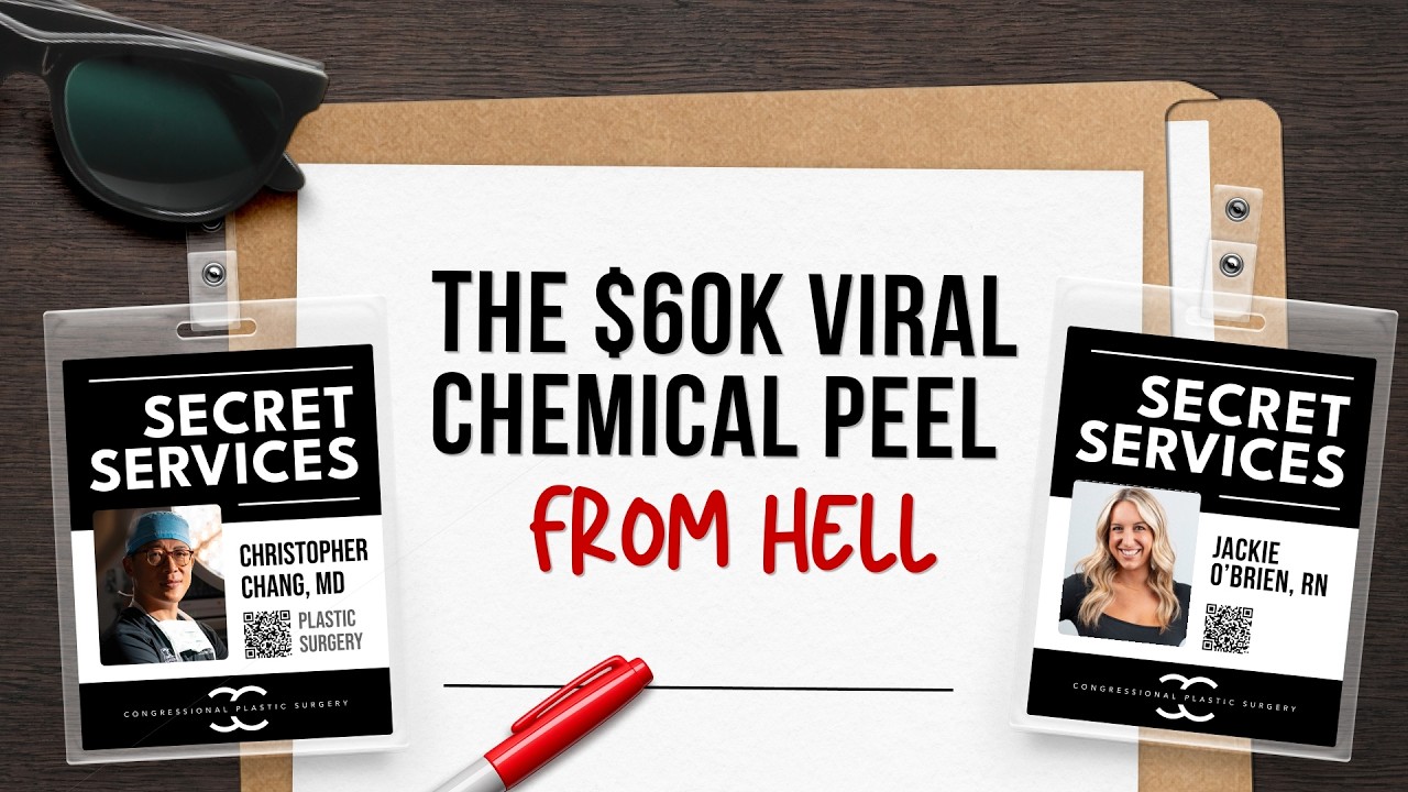 The $60k Viral Chemical Peel From Hell
