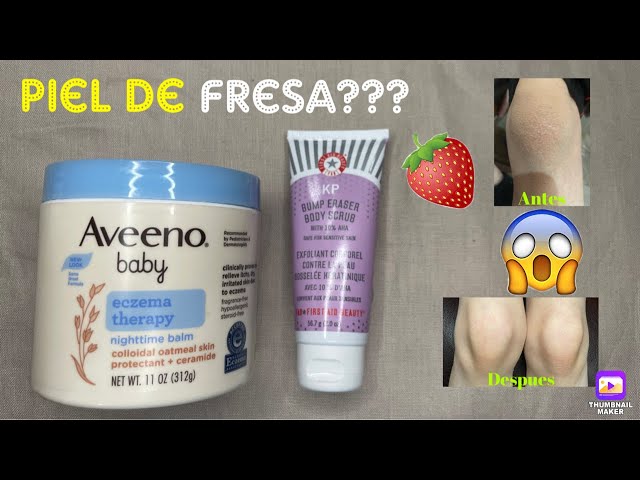 Vídeo relacionado con Gel Exfoliante Corporal Kp Bump Eraser para Queratosis Pilaris, Piernas de Fresa con ácido Salicílico AHA, Exfoliante Kp para Piel de Gallina, Zona del Bikini y los Glúteos con Esponja Vegetal Unisexo