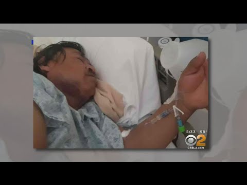 Street Vendor Hospitalized After Robbery In Baldwin Hills