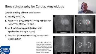 Pr PY MARIE AMYLOSE CARDIAQUE