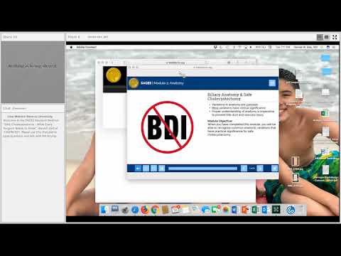 SAGES Webinar: Safe Cholecystectomy