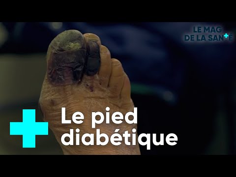 , title : 'Diabète, la médecine progresse 1/5 - Le Magazine de la Santé'