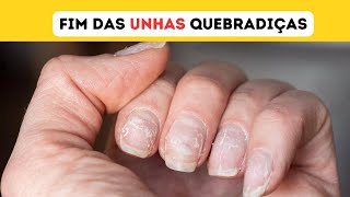 Suas unhas estão fracas e quebradiças? Vou te dar dicas valiosas de como ter unhas lindas sempre