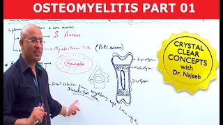 Osteomyelitis | Symptoms & Causes🩺