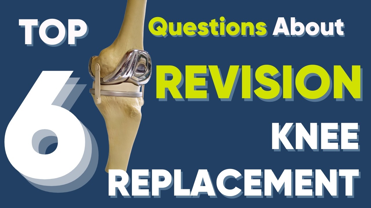 Top 6 tips about Revision Knee Replacement surgery!