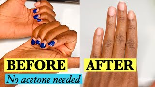 HOW TO REMOVE GEL AT HOME NO ACETONE NEEDED|Damage free  removal