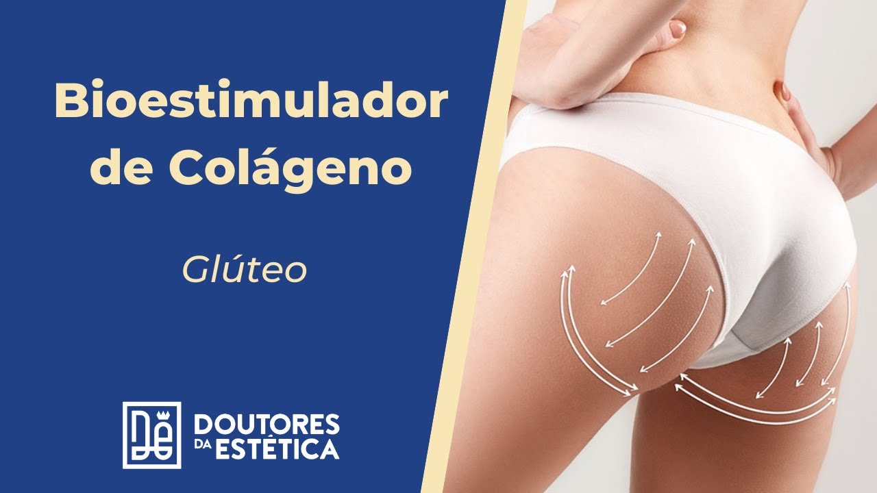 Bioestimulador de Colágeno - Glúteo