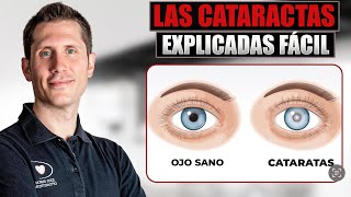 ✅ ¿Que son las CATARATAS de TUS OJOS