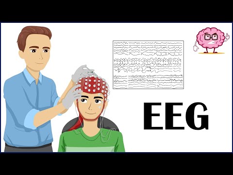 EEG (Electroencephalogram) - How It Is Done, Indications, Types Of EEG - Patient Education