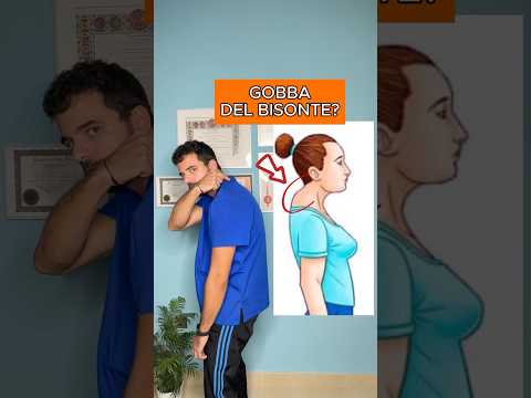 Gobba del Bisonte Esercizio Semplice del fisioterapista #gobba #cervicale #cervicalgia
