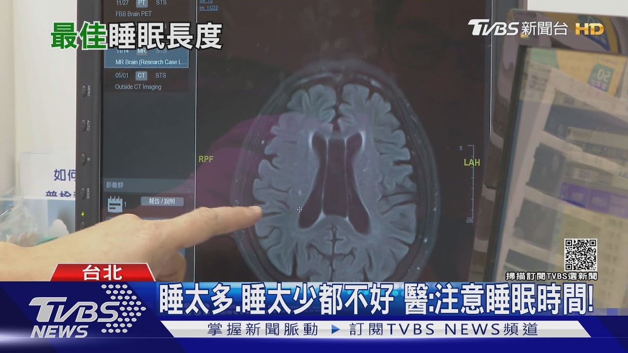 有片／研究：預防「阿茲海默症」每天維持這件事　降低罹病風險！