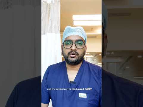 Appendix surgery - Laparoscopic or Open which is better??