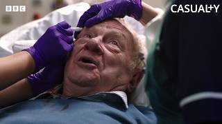 A Husband’s Secret About His Ex-Wife With Alzheimer’s Finally Comes Out! | Casualty