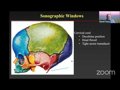 Ultrasound of the Pediatric Spine- Prof. George Taylor- April 17th 2021
