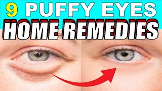 9 Quick Home Remedies To Treat Puffy Eyes & Bags Naturally | Causes of Puffy Eyes