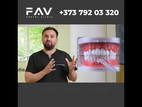 Vă este frică că organismul ar putea respinge implantul dentar?