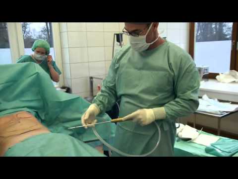 Warum grudnichka pop Gelenke Ob eine Übereinstimmung mit Hämorrhoiden Rücken und Bauch
