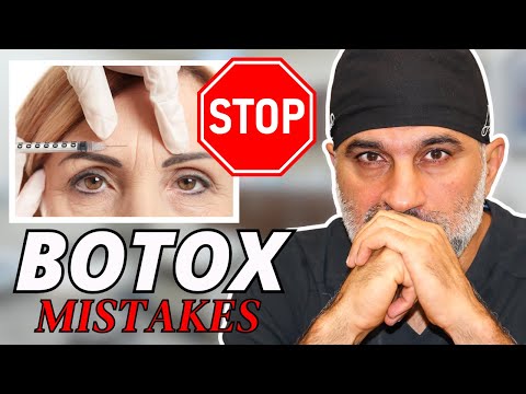 WATCH before getting Botox! (Big Botox Mistakes!)