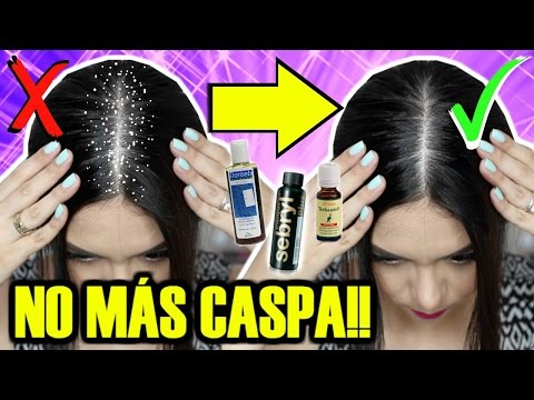 EL MEJOR SHAMPOO PARA LA CASPA?? | MARIEBELLE COSMETICS Video