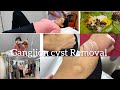 Oru Hospital Vlog Ganglion Cyst Removal Anumol Cyst Removal Ganglion Cyst