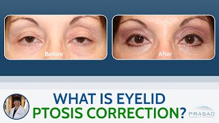What is Eyelid Ptosis Correction?