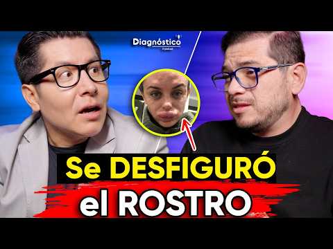 😱¡TERRIBLE! Las PEORES CIRUGÍAS PLÁSTICAS de FAMOSOS | #Diagnóstico 129 | Mr Doctor