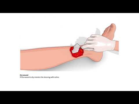 How to use PROMOGRAN and PROMOGRAN PRISMA