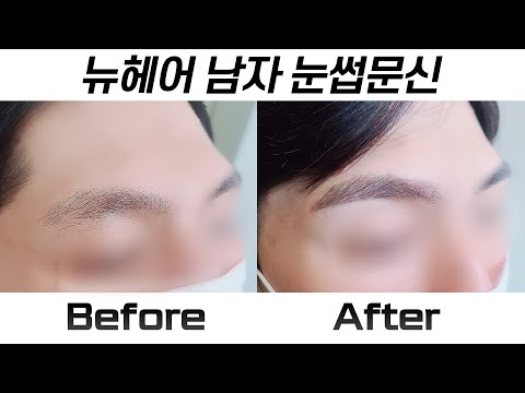 남자 눈썹문신 시술 전후 I 뉴헤어 BMP I 눈썹문신 I Before&After