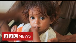 Yemen facing world’s “worst famine in decades”  - BBC News