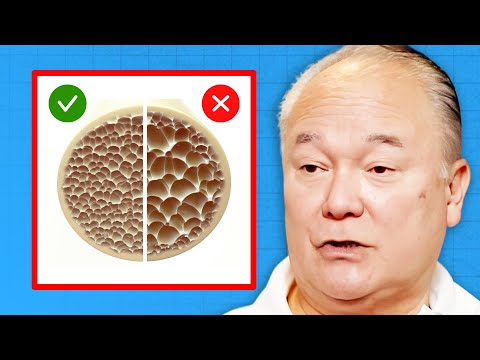 The BEST WAYS to Build Strong Bones WITHOUT Calcium Supplements | Dr. William Davis