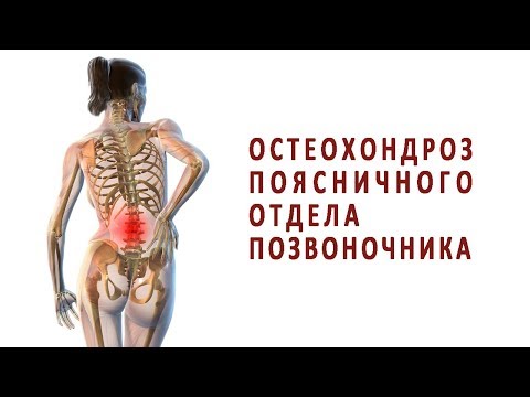 Комплекс упражнений при переломе голеностопного сустава Кифоз позвоночника лечение видео